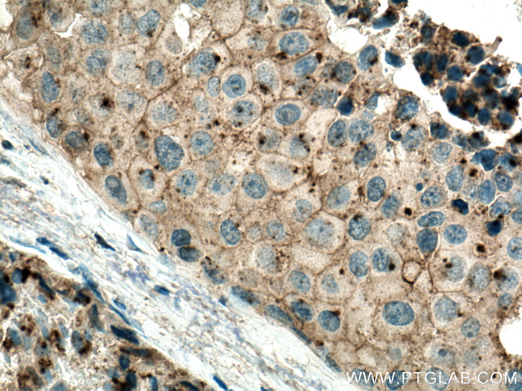 Flotillin 2 Monoclonal antibody