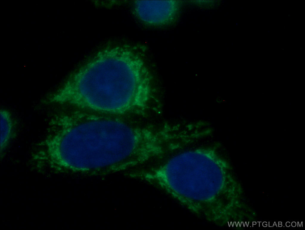 mTOR Monoclonal antibody
