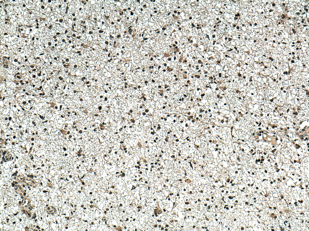 TERF2 Monoclonal antibody