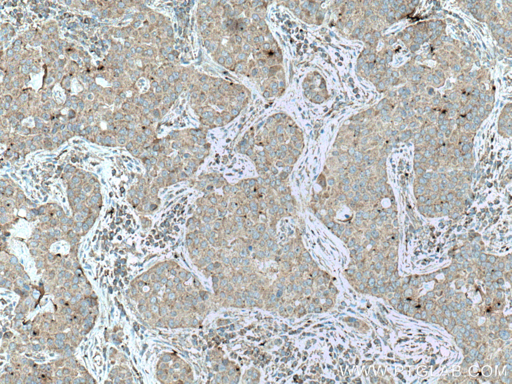 UPF1 Monoclonal antibody
