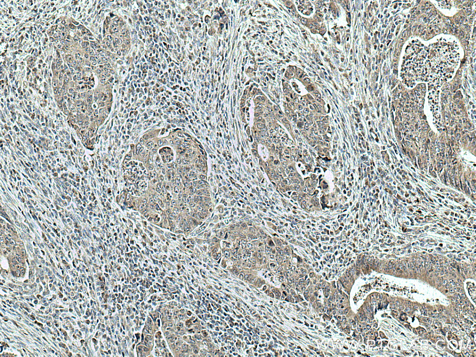 SPTLC1 Monoclonal antibody