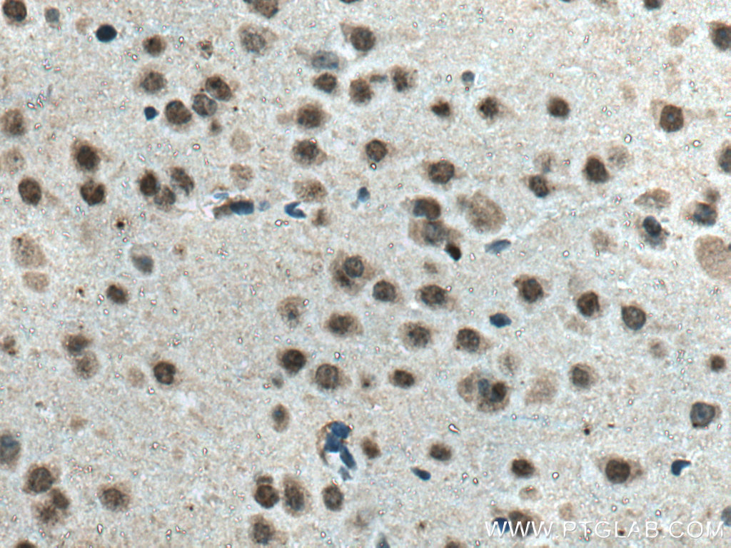 Glucocorticoid receptor Monoclonal antibody