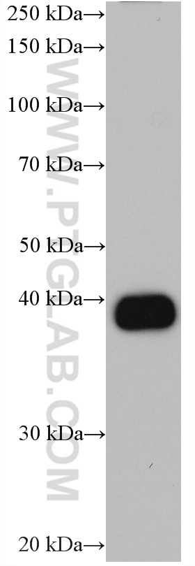 CA6 Monoclonal antibody