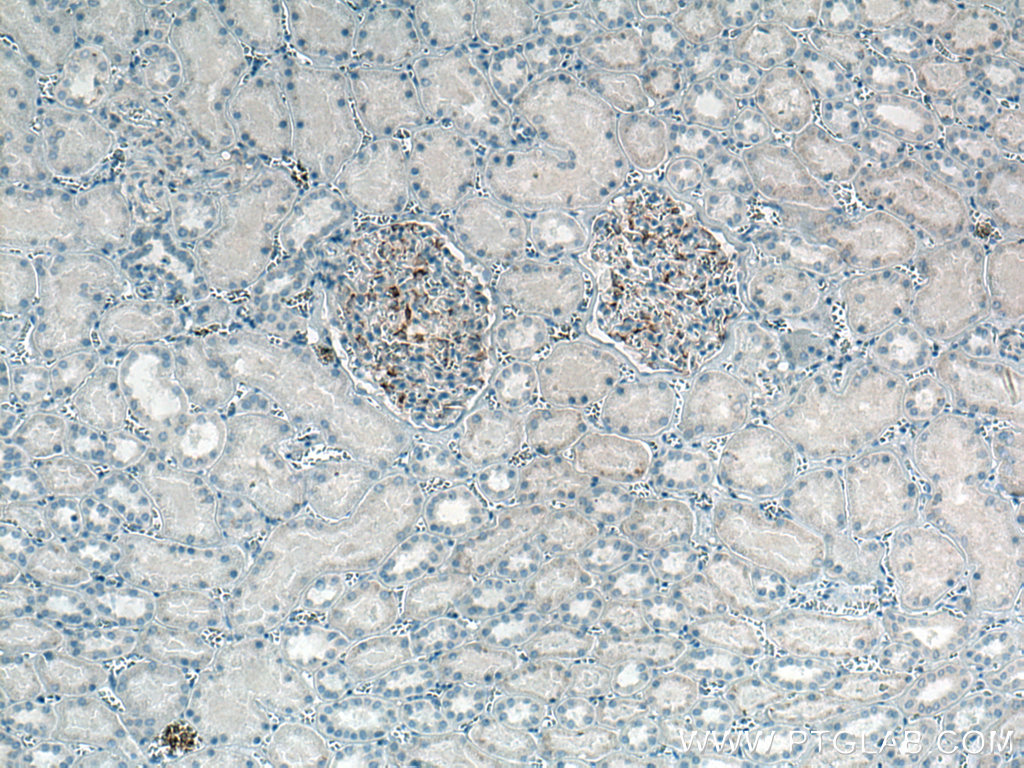 INF2 Monoclonal antibody