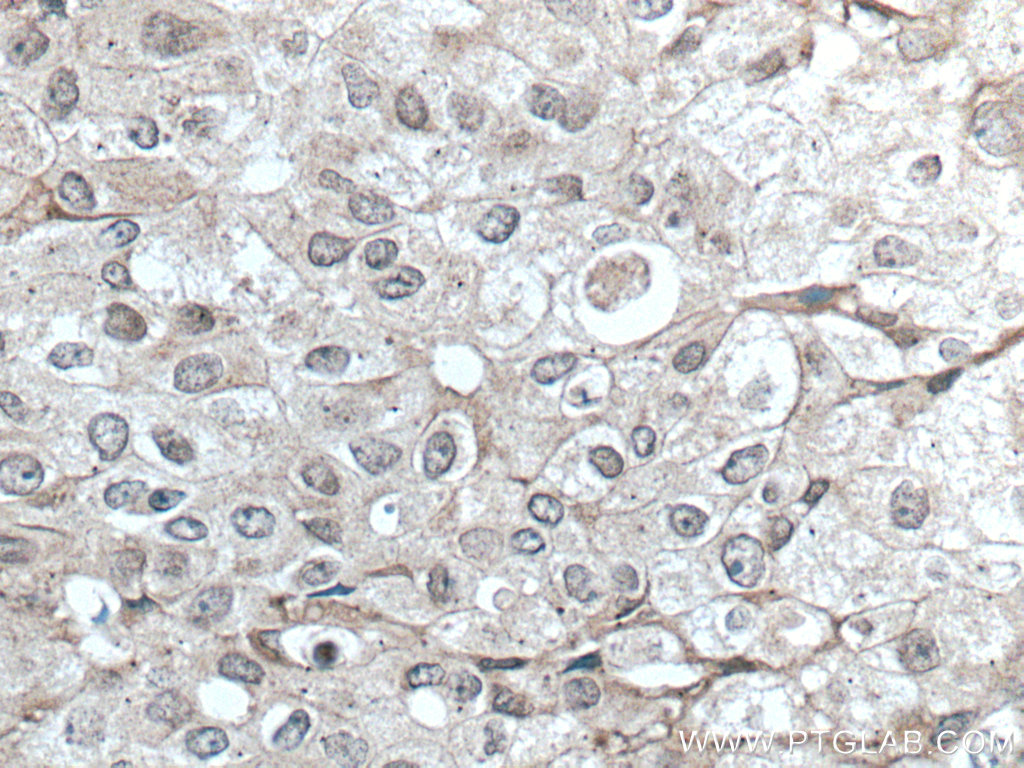 TFG Monoclonal antibody