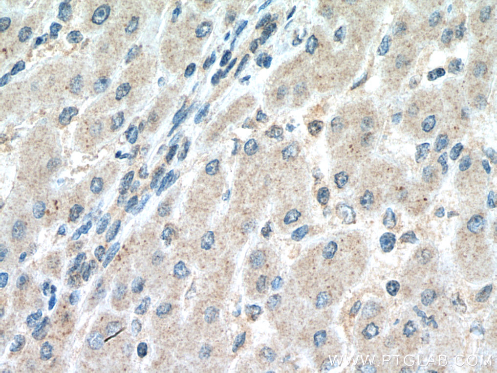 NFKB2 Monoclonal antibody