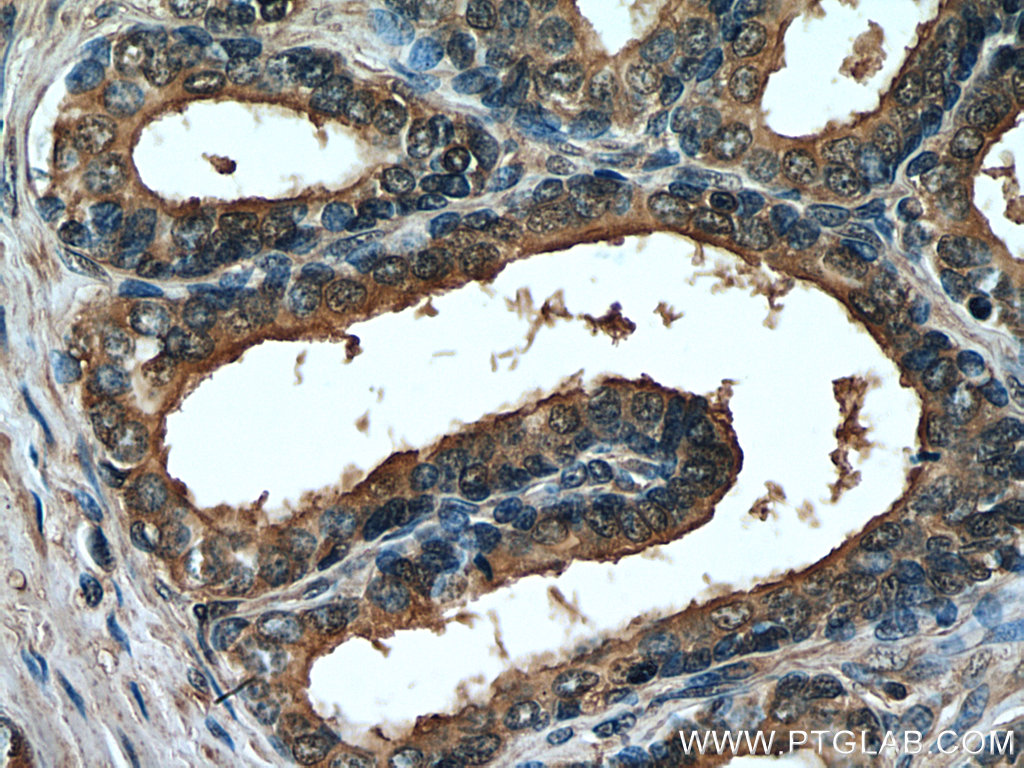 PTGER4 Monoclonal antibody