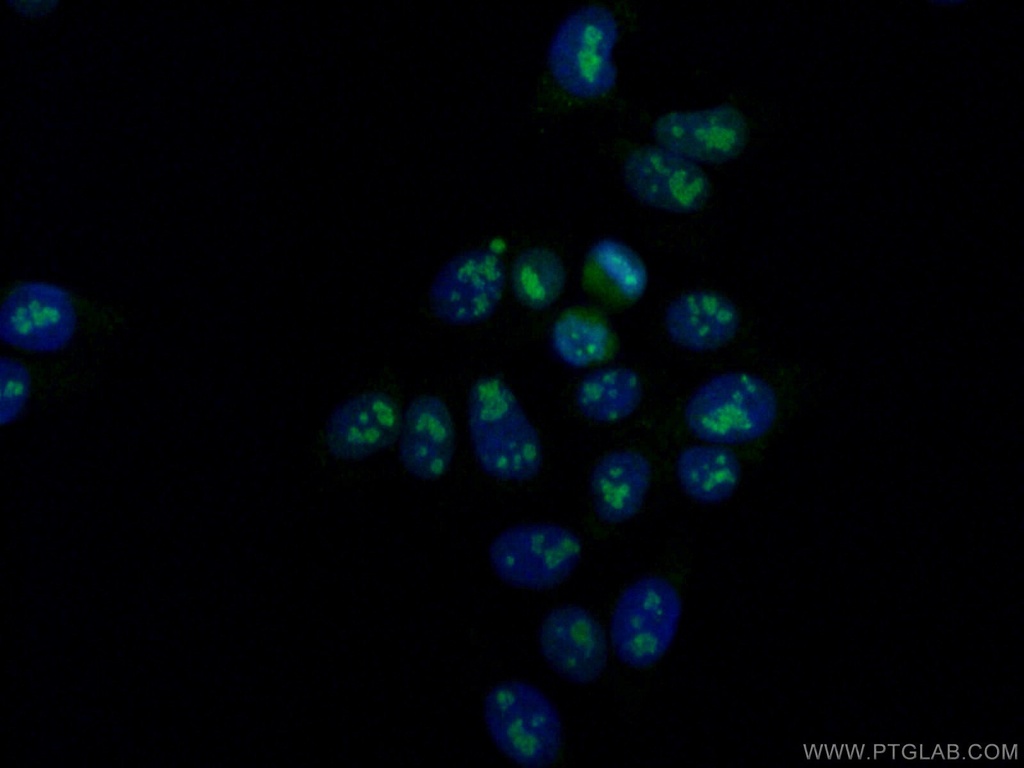 DDX21 Monoclonal antibody