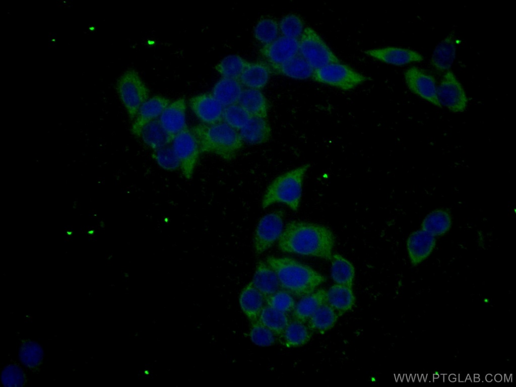 GPNMB Monoclonal antibody