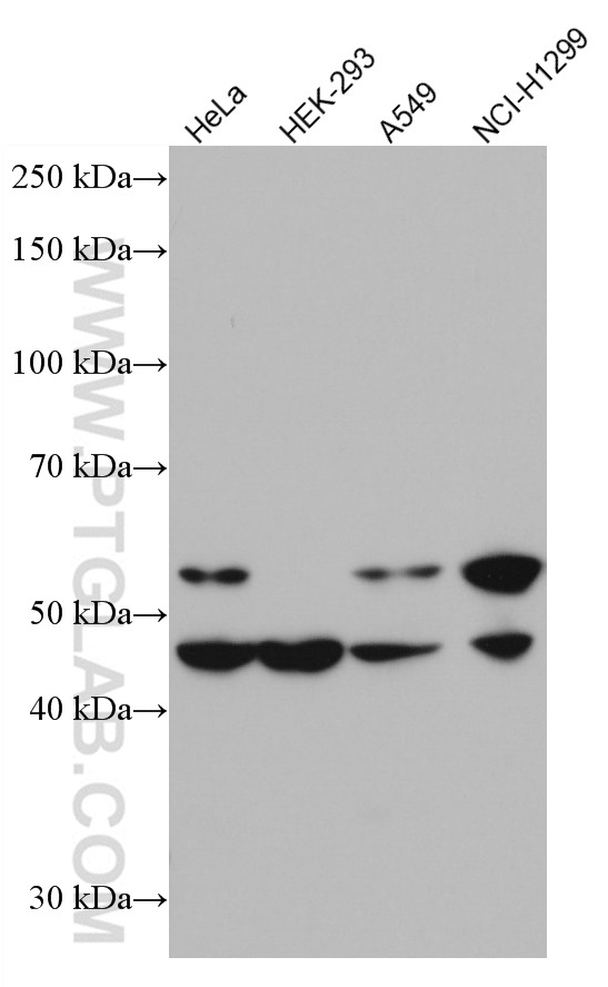 MMP12 Monoclonal antibody