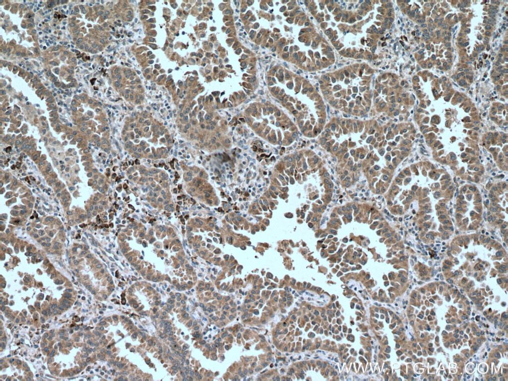 PHEX Monoclonal antibody