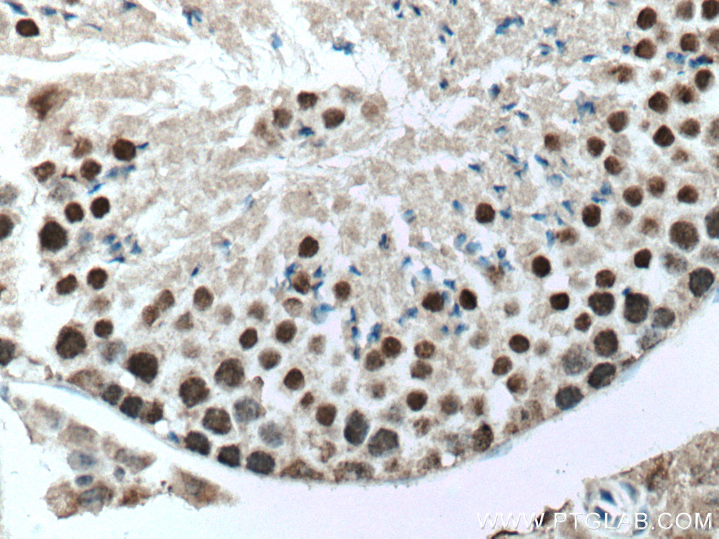 UBR5 Monoclonal antibody