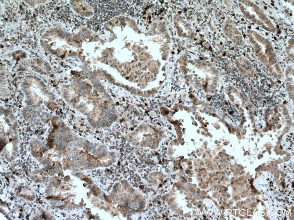 RAB27B Monoclonal antibody
