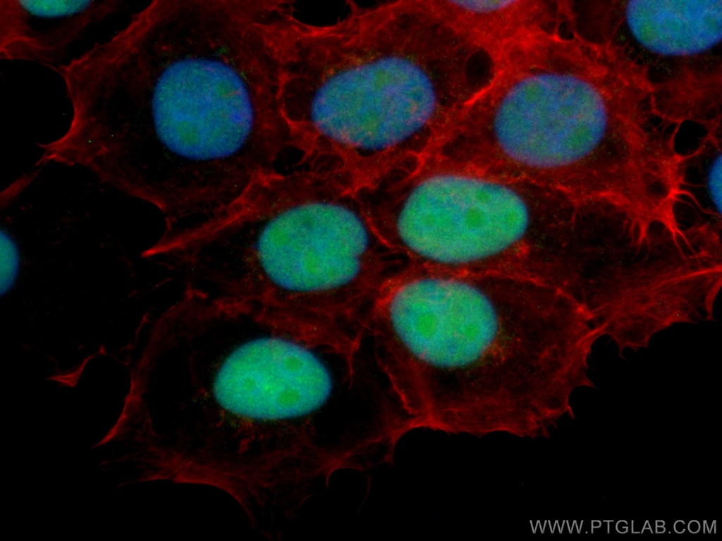 DBR1 Monoclonal antibody