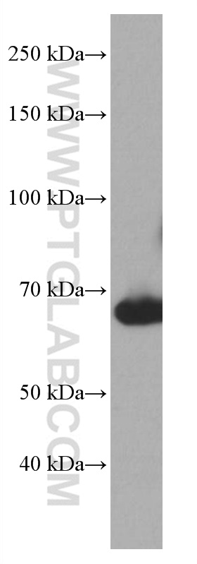 BLNK Monoclonal antibody