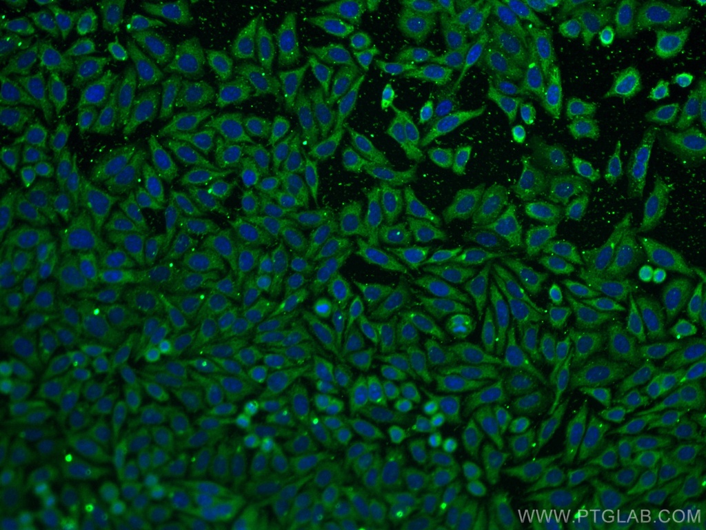 FGFR3 Monoclonal antibody