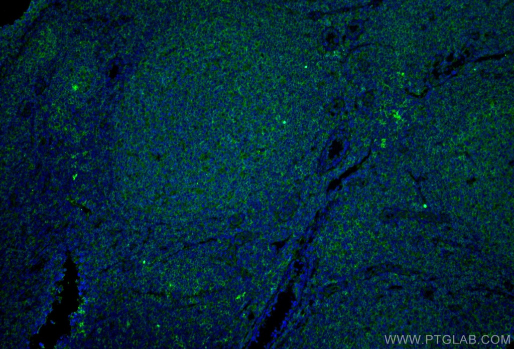 CD40 Monoclonal antibody
