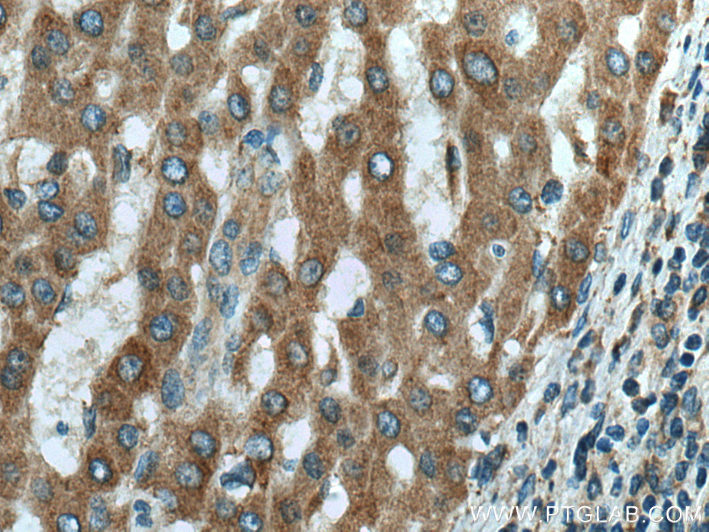 DOCK2 Monoclonal antibody