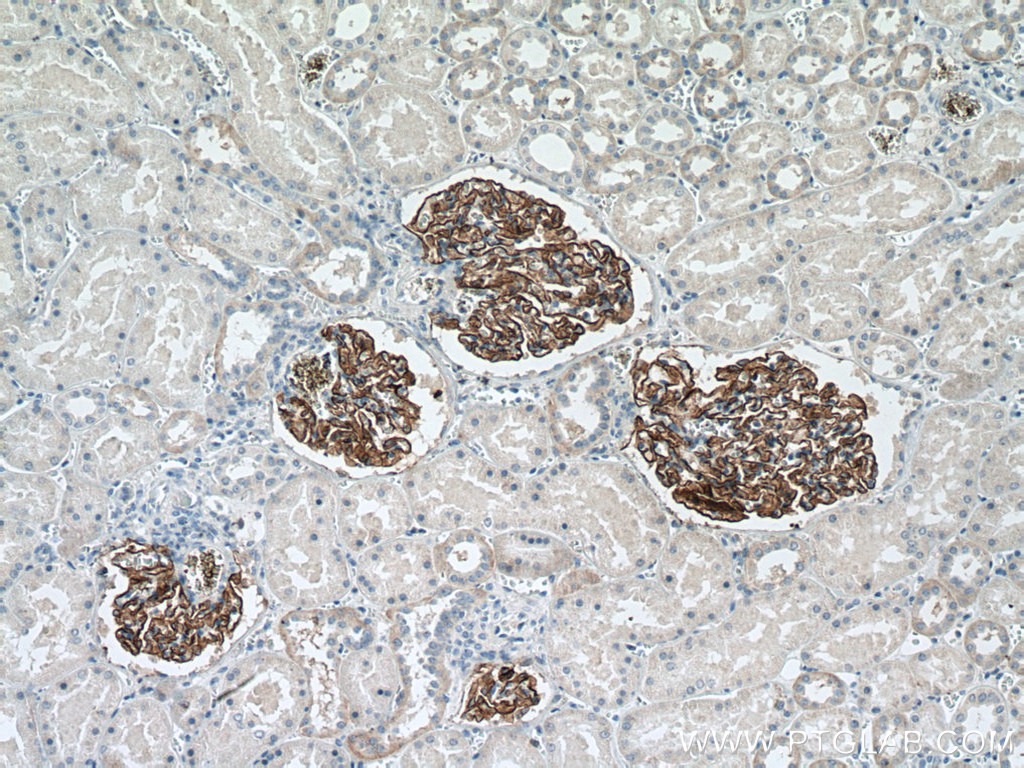 Nephrin Monoclonal antibody