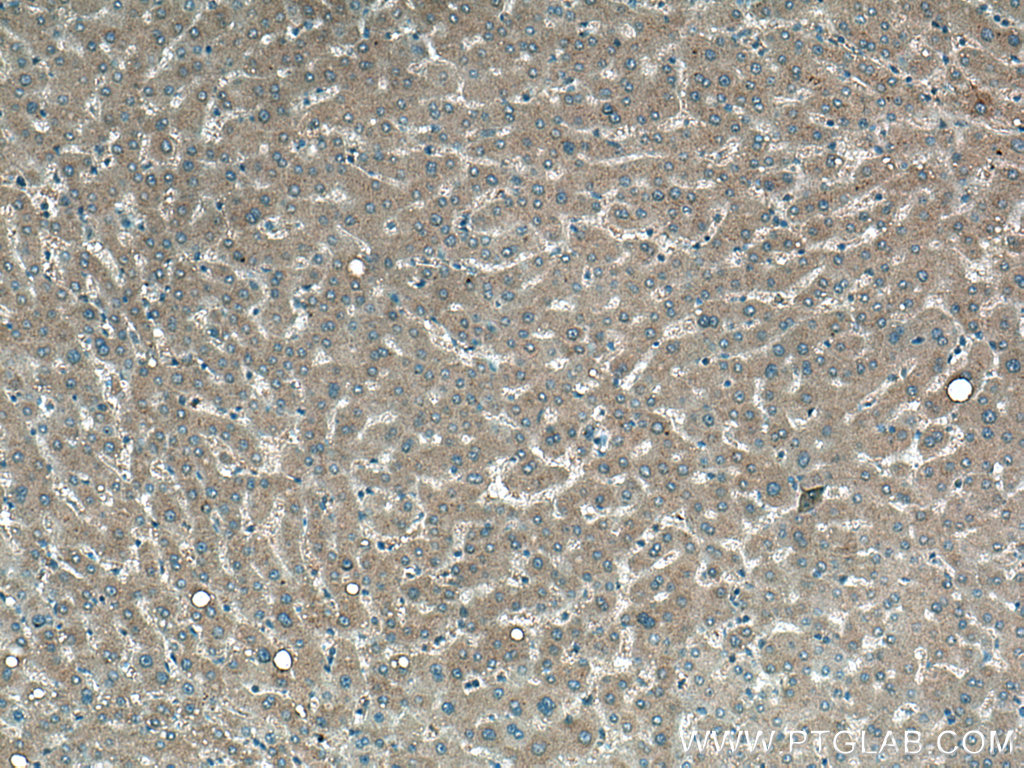 EPO Monoclonal antibody