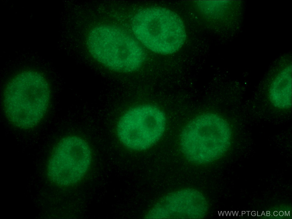 NBN Monoclonal antibody