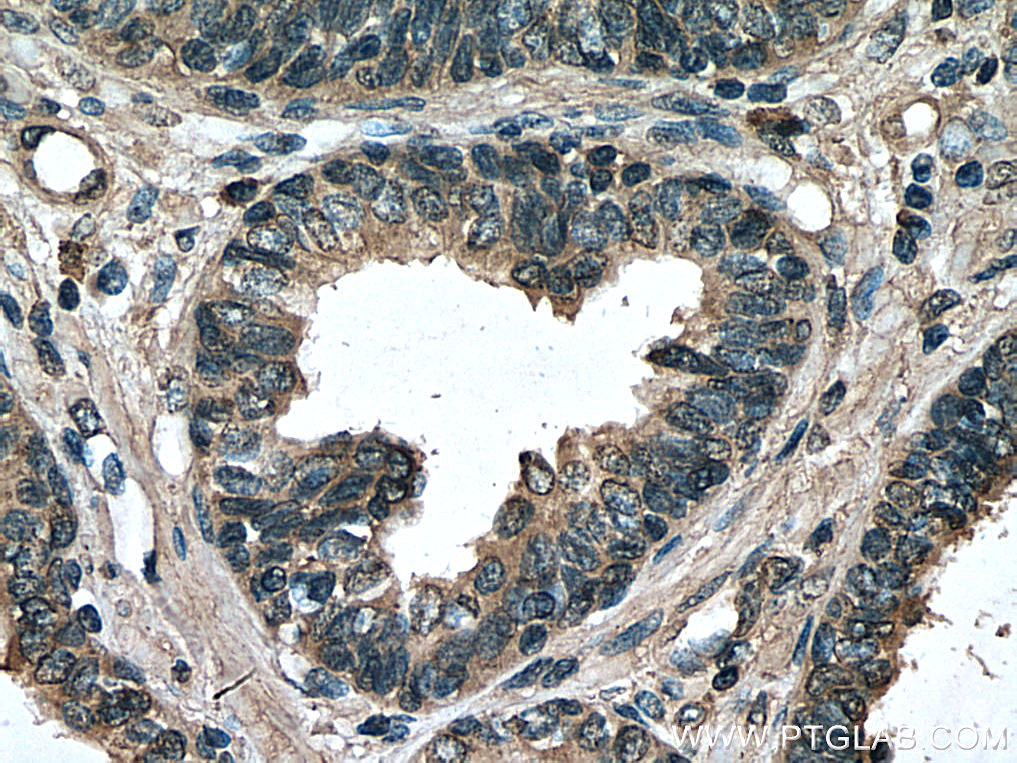 PREB Monoclonal antibody