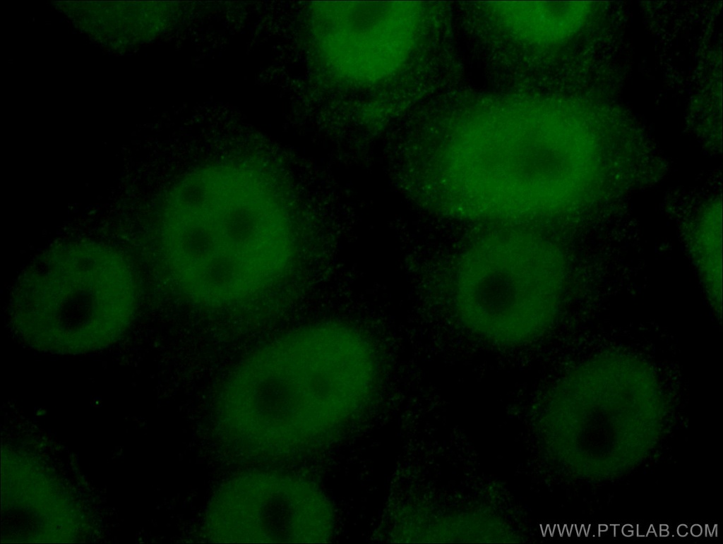CTBP1 Monoclonal antibody
