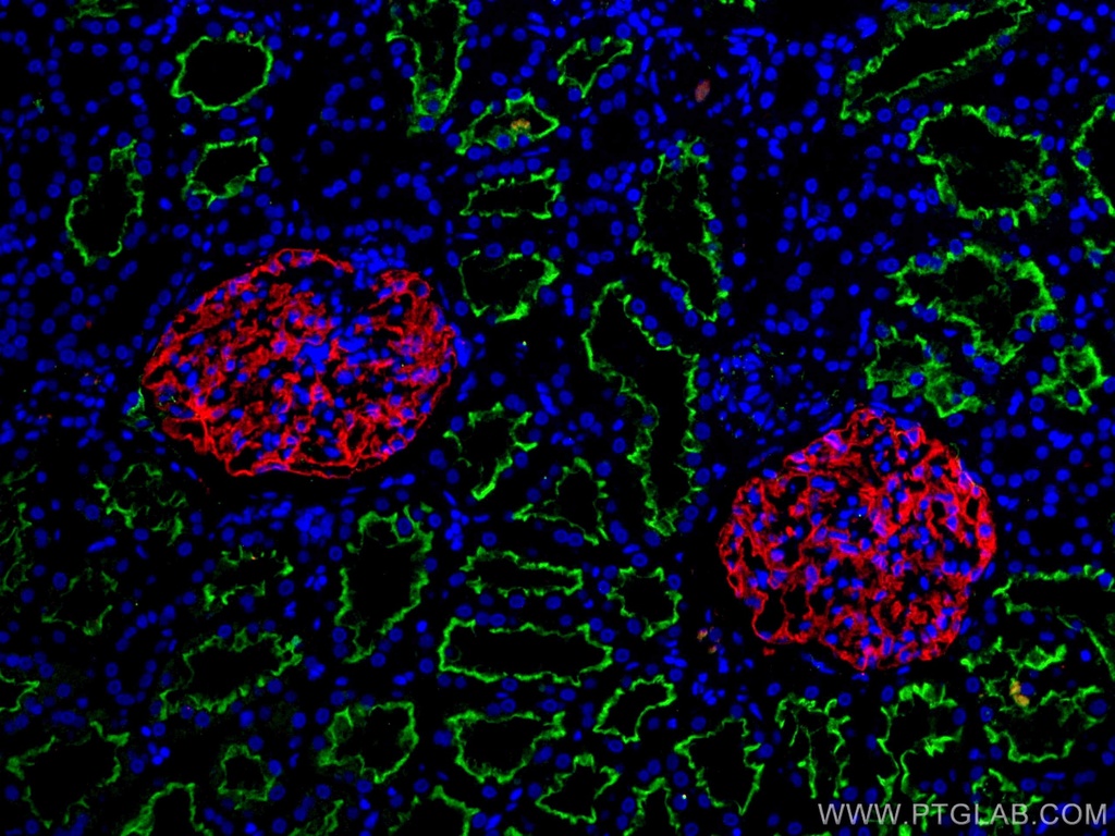 PTPRO Monoclonal antibody