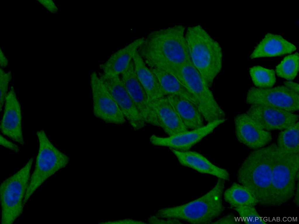 RRM2 Monoclonal antibody