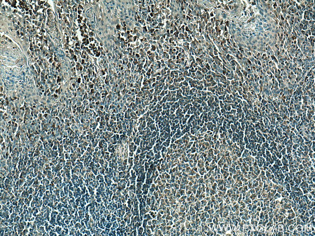 PLCG2 Monoclonal antibody