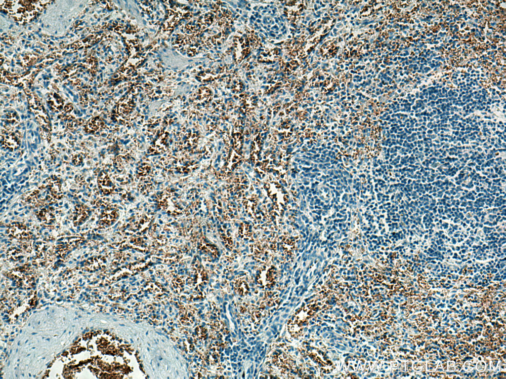 ICAM4 Monoclonal antibody