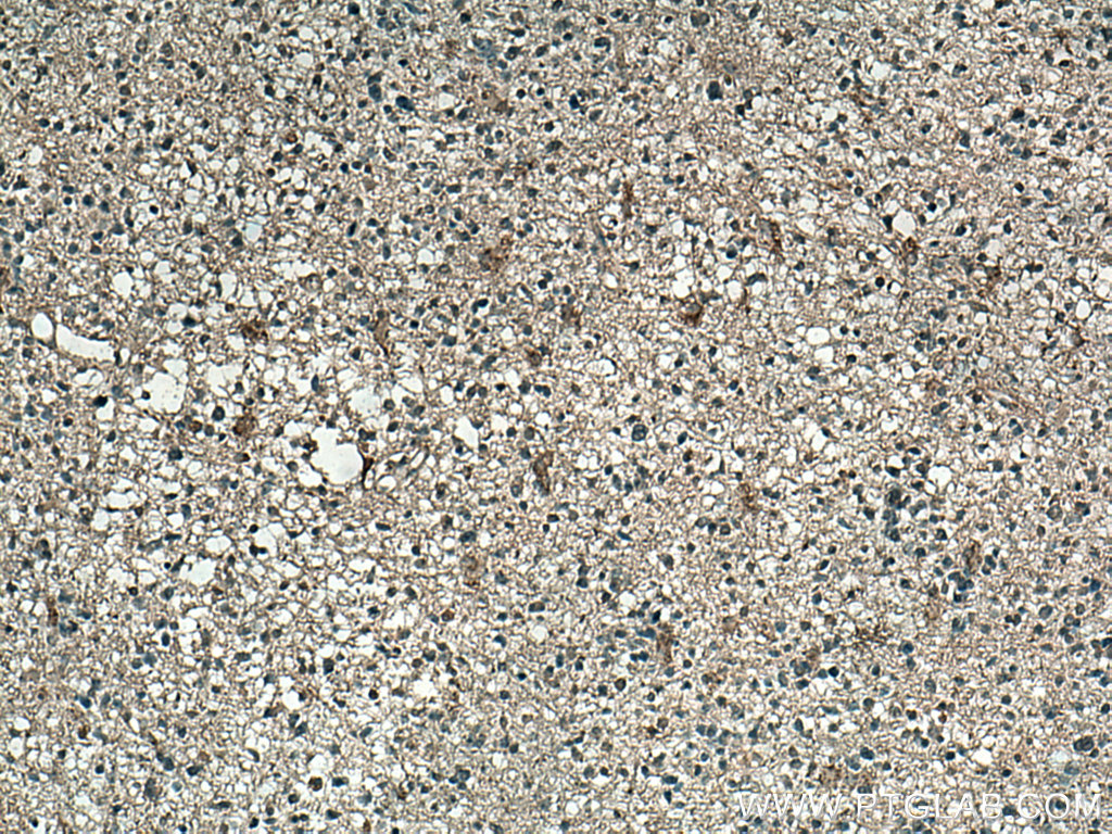 Frizzled 9 Monoclonal antibody