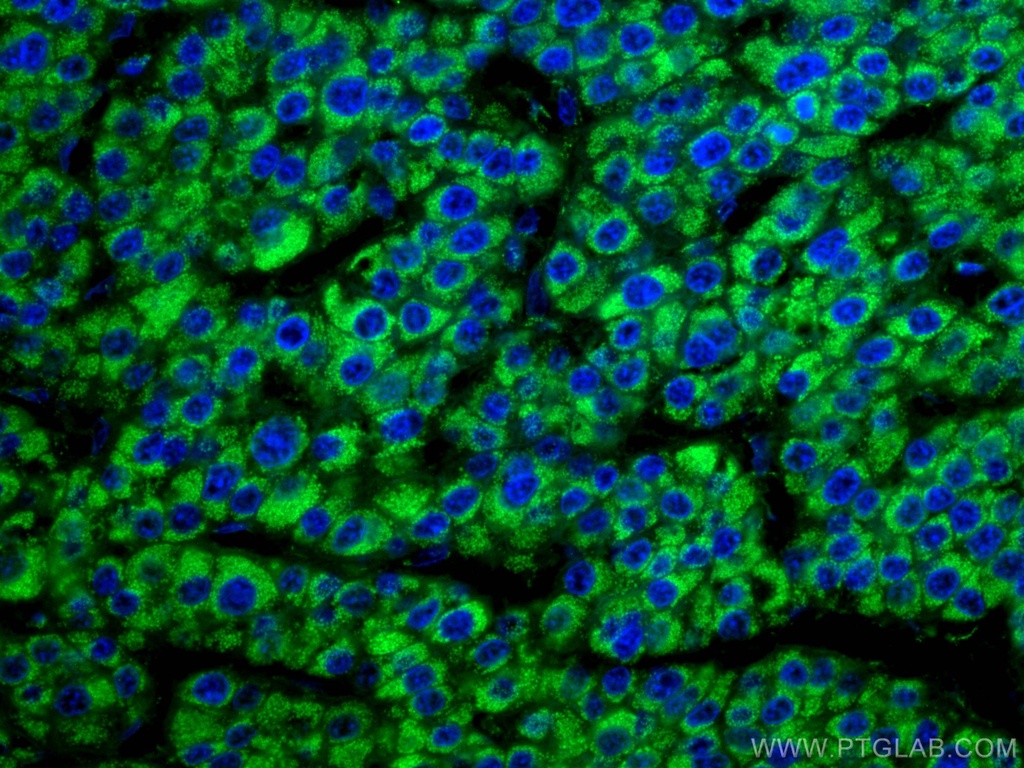 GLUD1 Monoclonal antibody