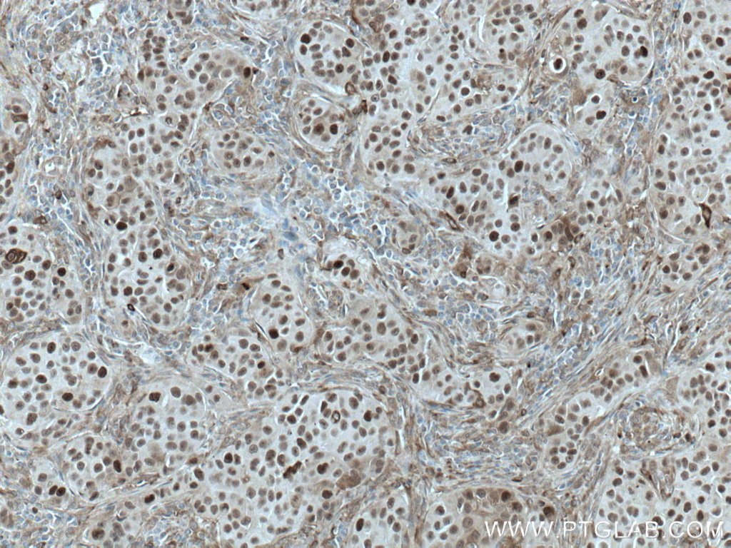 PRC1 Monoclonal antibody