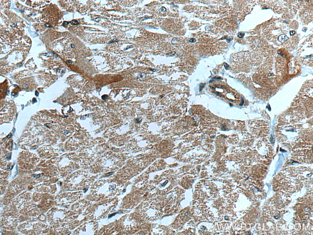 CUL7 Monoclonal antibody
