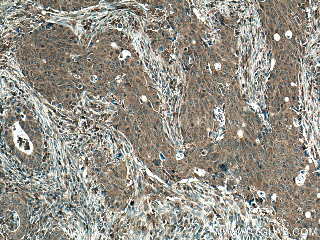 FLII Monoclonal antibody