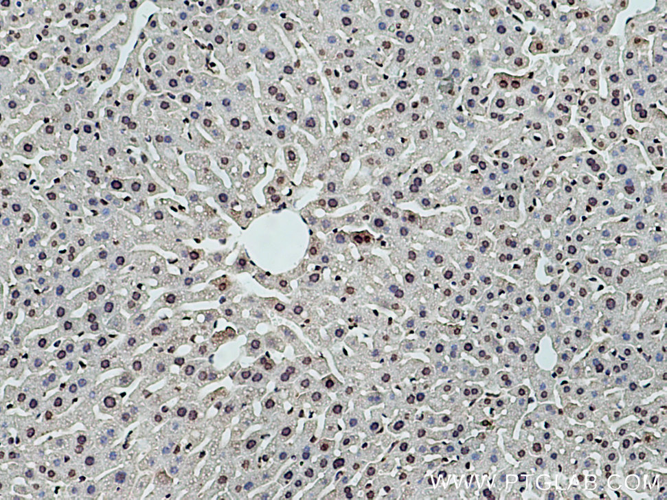 DNASE1L3 Monoclonal antibody