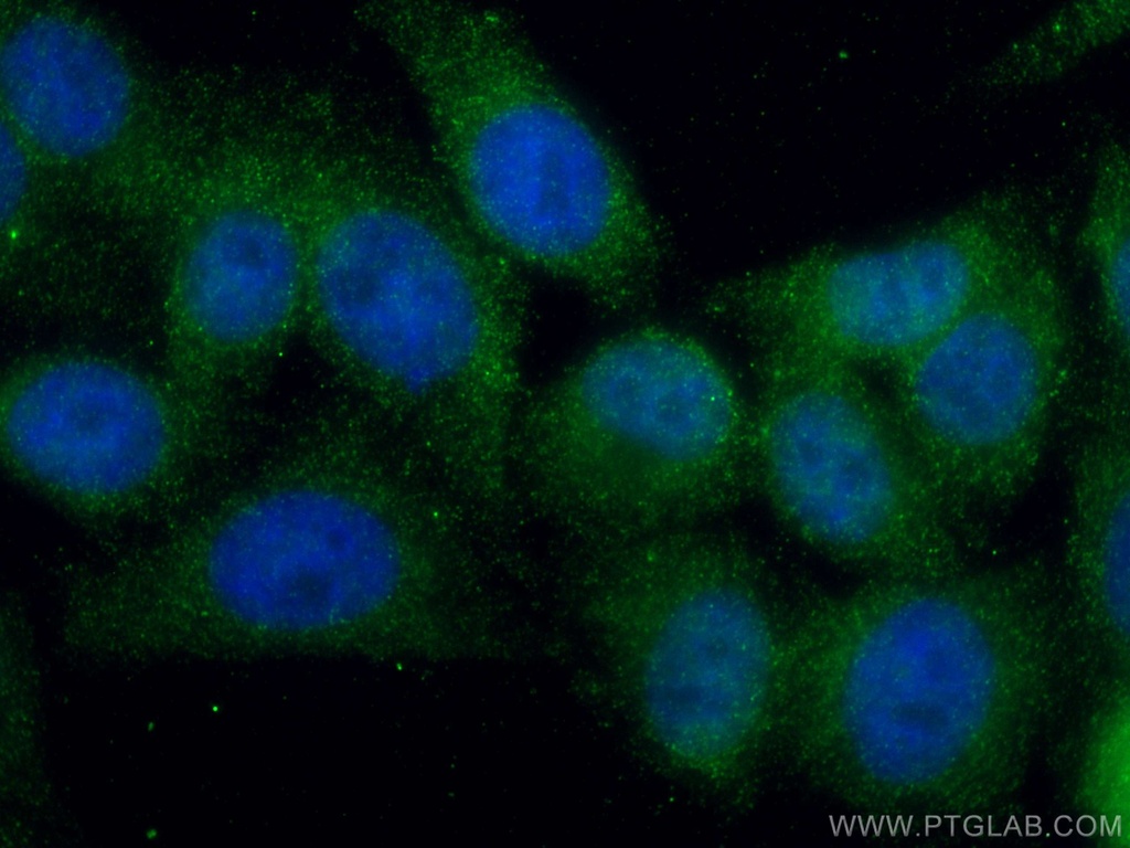 MLX Monoclonal antibody