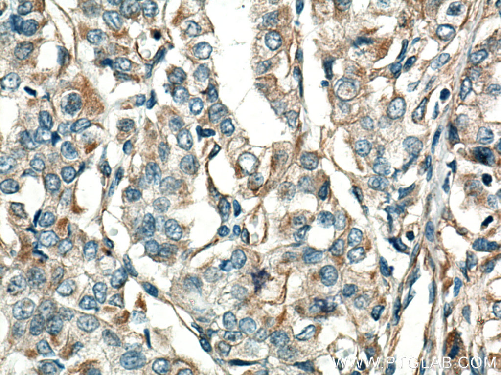 GUK1 Monoclonal antibody