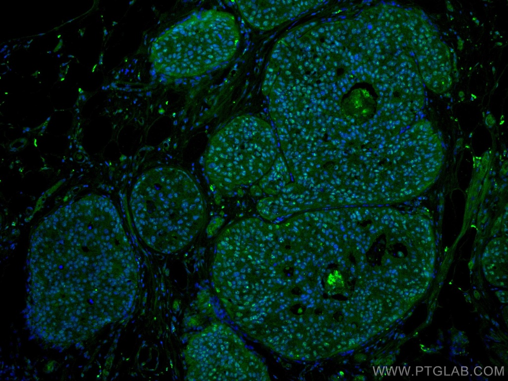 PELP1 Monoclonal antibody