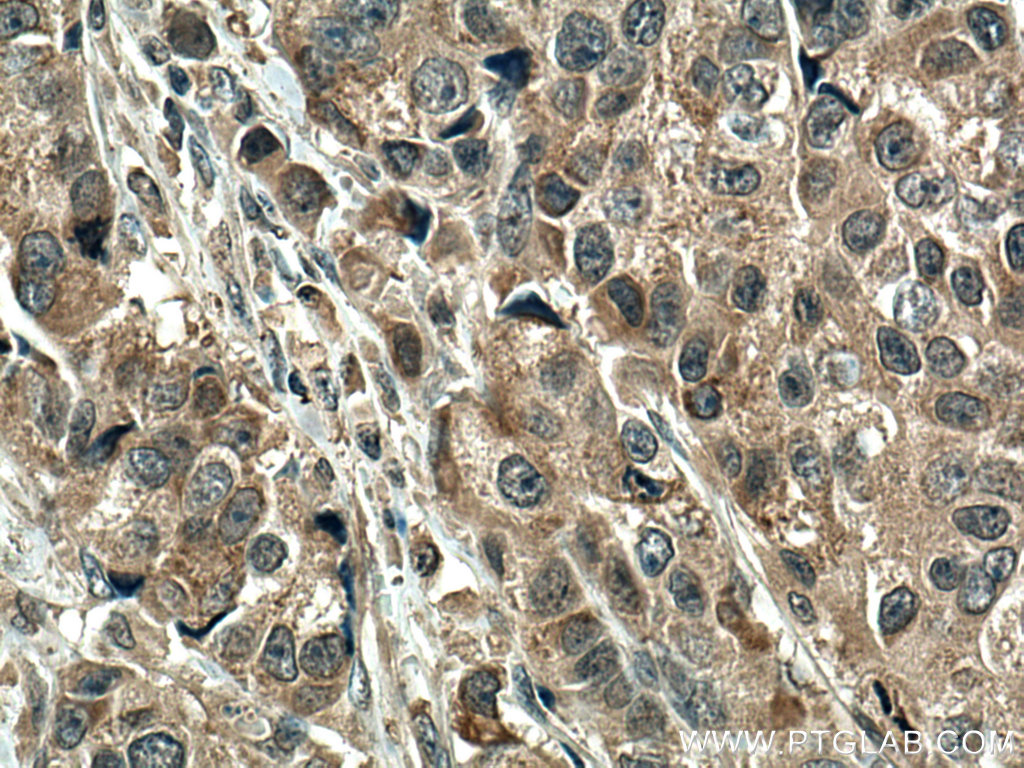 SMAD5 Monoclonal antibody