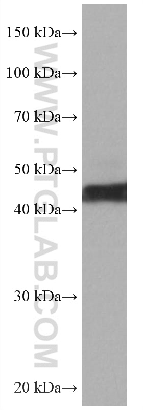 ATX3,ATXN3 Monoclonal antibody