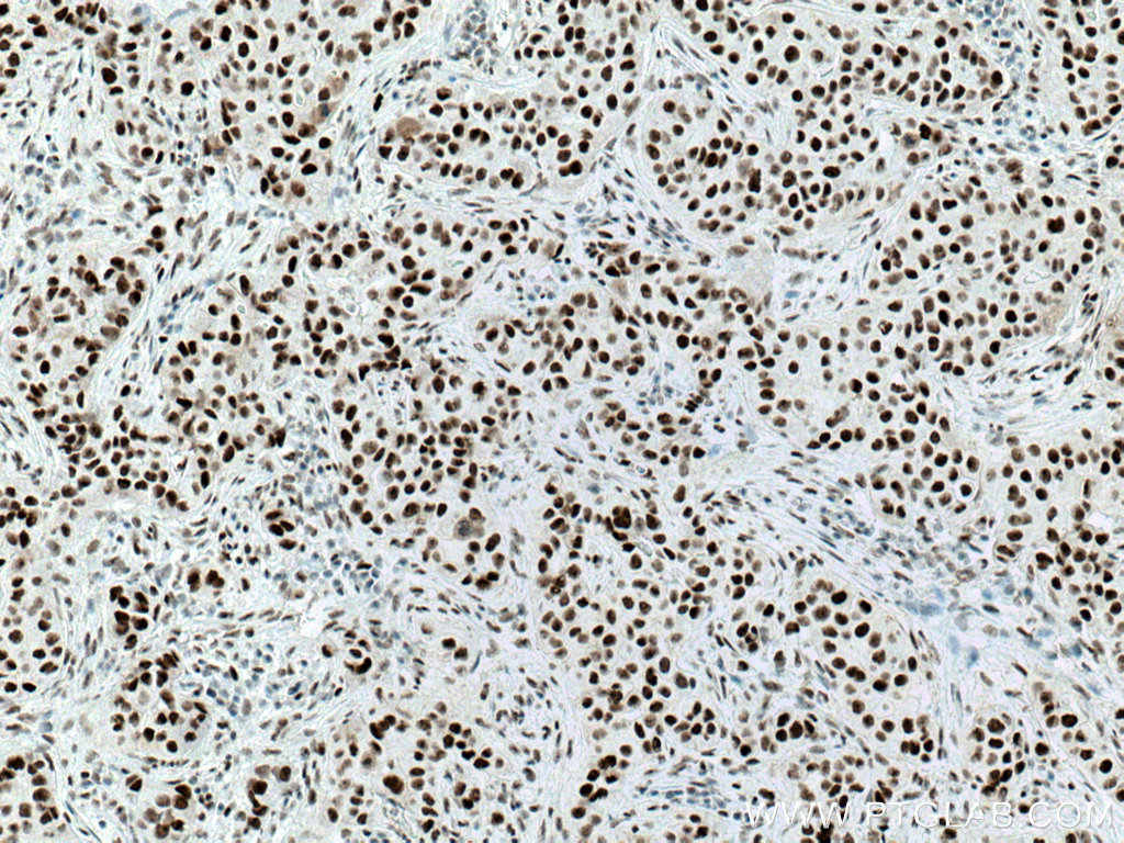 Cyclin H Monoclonal antibody