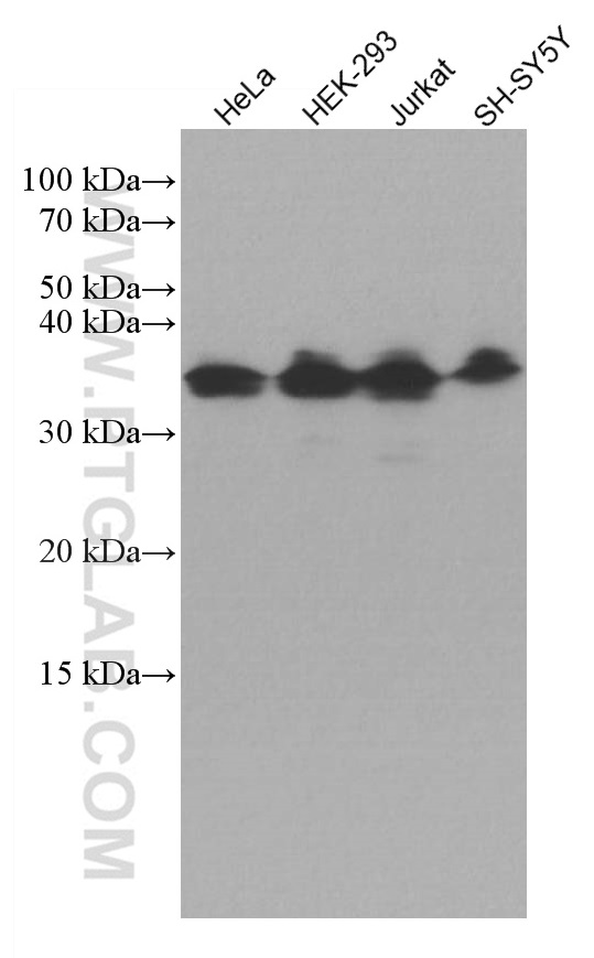 ATF5 Monoclonal antibody