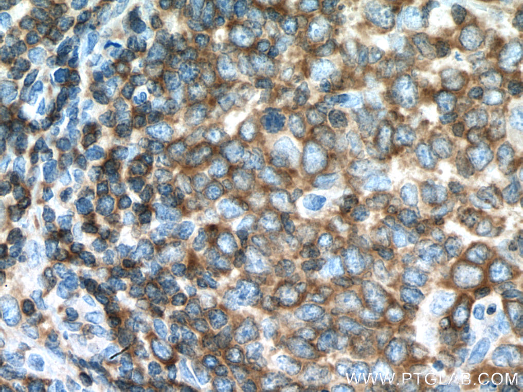 ADRBK1 Monoclonal antibody