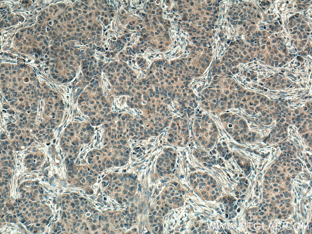 PI3 Kinase p110 Alpha Monoclonal antibody