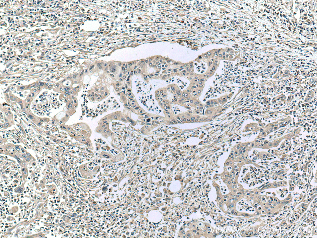 ASK1 Monoclonal antibody