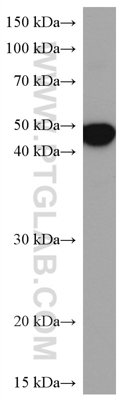 Alpha Sarcoglycan Monoclonal antibody