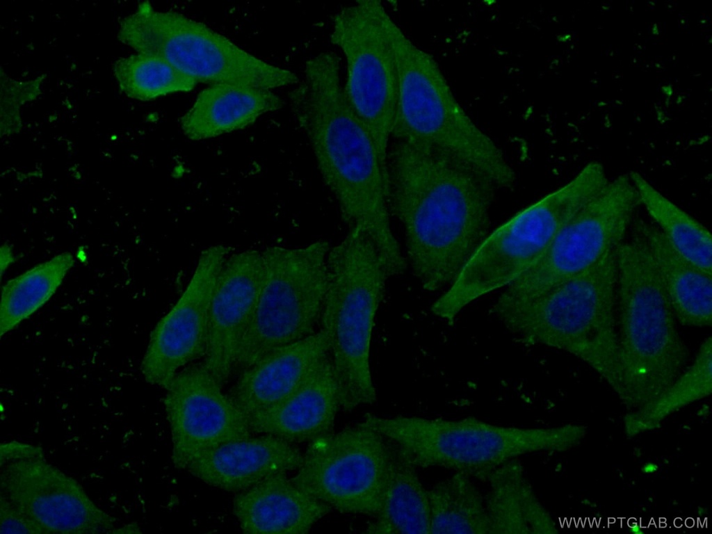 CES1 Monoclonal antibody