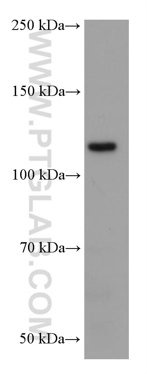 EPHB1 Monoclonal antibody